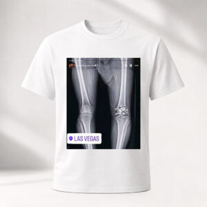 Unisex Funny Conor McGregor X Ray Broken Knee Graphic Shirt for MMA Fans